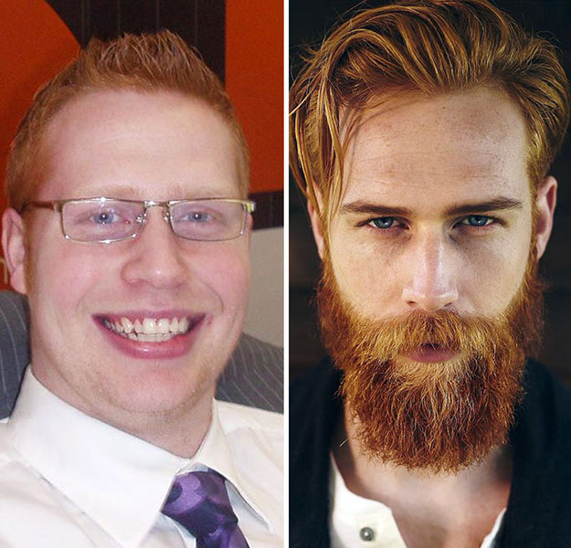 90 Fascinating Before And After Beard Pics, As Shared By Guys Who Ditched The Razor And Let It Grow Wild And Free